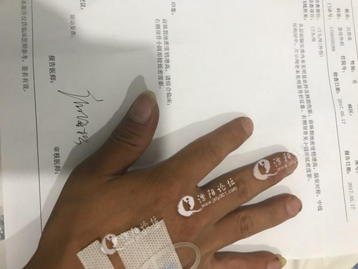 广曰电梯变压器_广日电梯员工工资收入(2)