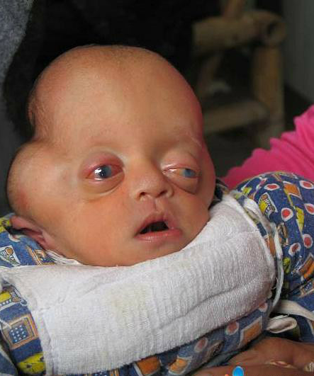 一女产下奇特男婴 面貌酷似"外星人"