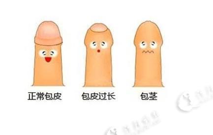 成年人包皮过长的五大隐患