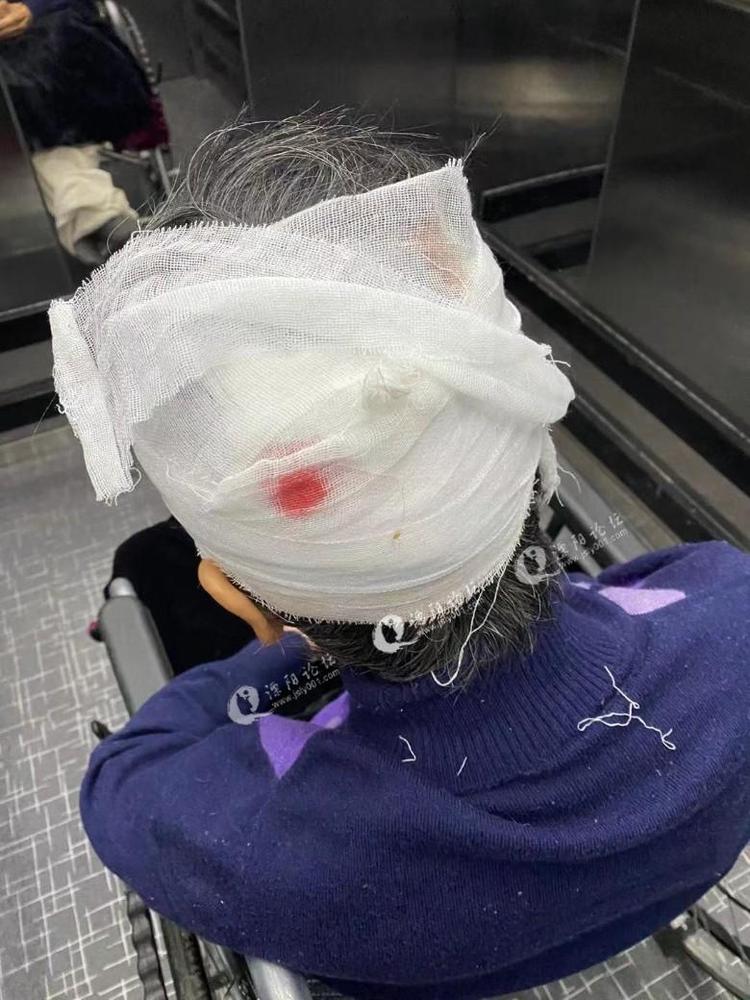 溧阳某养老院仅一天时间将老人摔成颅内出血,性命堪忧!